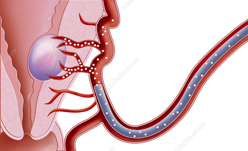 3. Admission and UFE